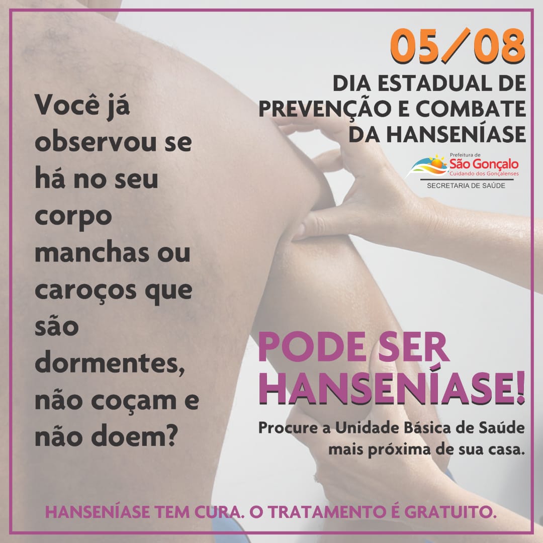 Hanseníase, Combate e Prevenção